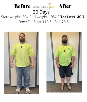 Weight Loss Brookfield WI Before And After