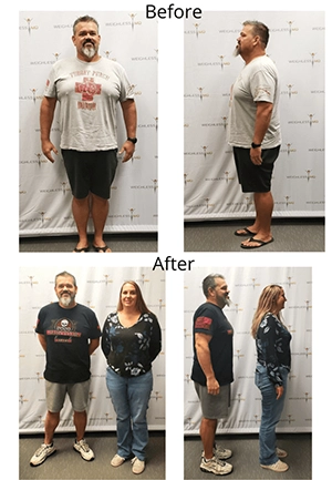 Weight Loss Brookfield WI Before And After