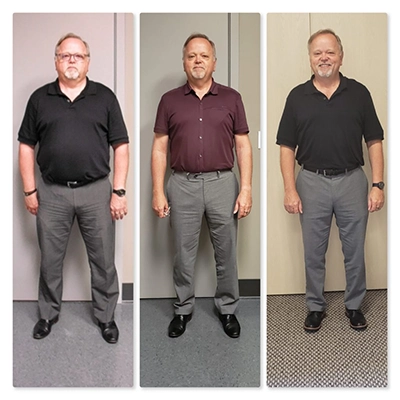 Weight Loss Brookfield WI Before And After