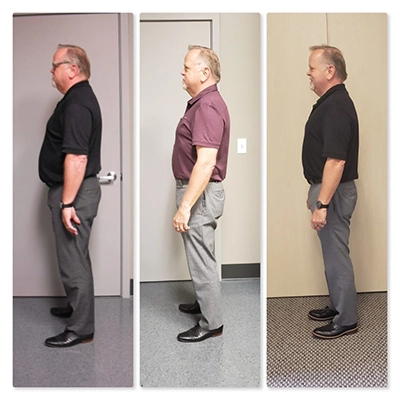 Weight Loss Brookfield WI Before And After