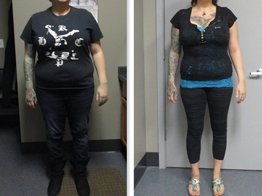 Weight Loss Brookfield WI Before And After