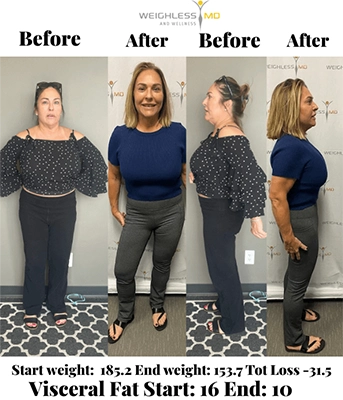 Weight Loss Brookfield WI Before And After