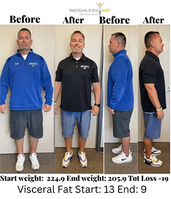 Weight Loss Brookfield WI Before And After