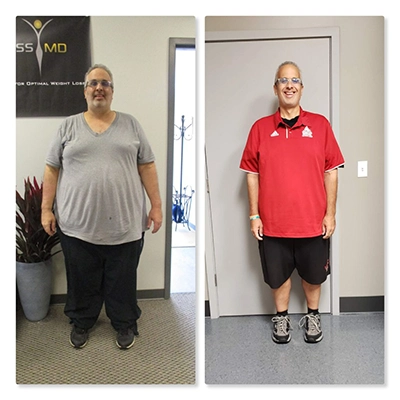 Weight Loss Brookfield WI Before And After