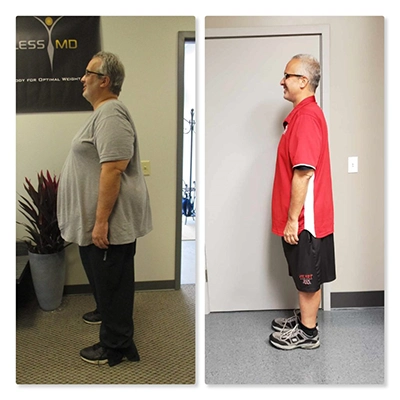 Weight Loss Brookfield WI Before And After