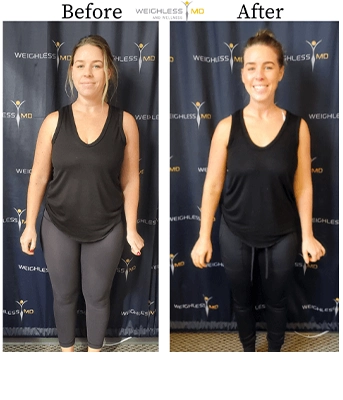 Weight Loss Brookfield WI Before And After