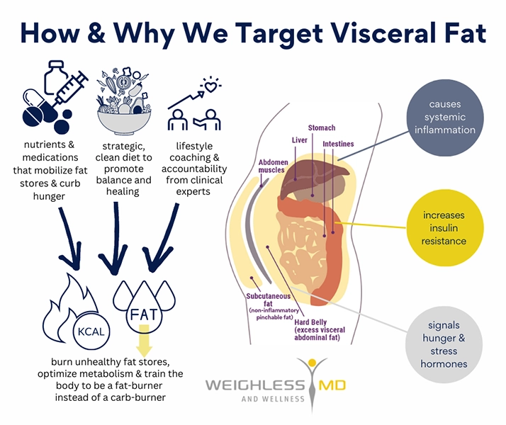 Weight Loss Brookfield WI Visceral Fat Diagram